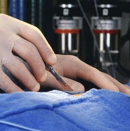 Weight Loss Bypass Surgery