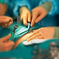 Weight Loss Surgery Complications