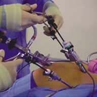 Weight Loss Surgery Success